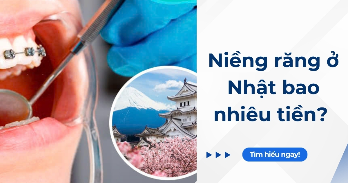 Niềng răng nghỉ ngơi nhật bao nhiêu tiền Niềng răng ngơi nghỉ nhật từng nào tiền